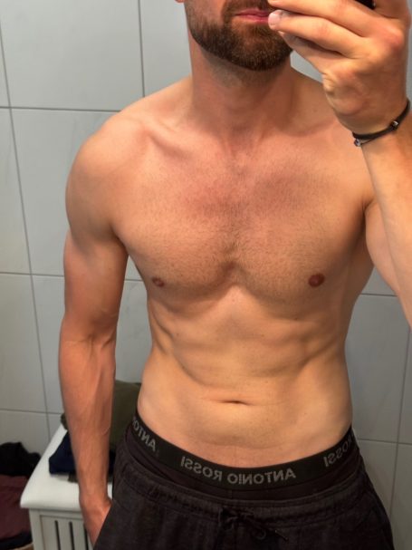 Alex nachher